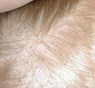 hoofdluis-haar